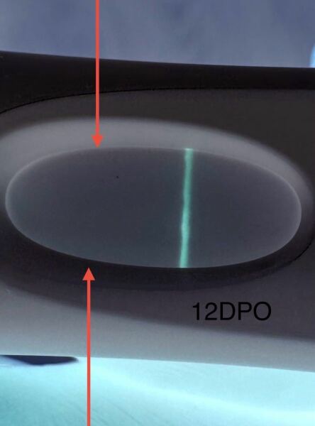 LINE EYE VETERANS NEEDED!❤️