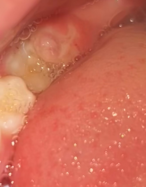 Is this normal?