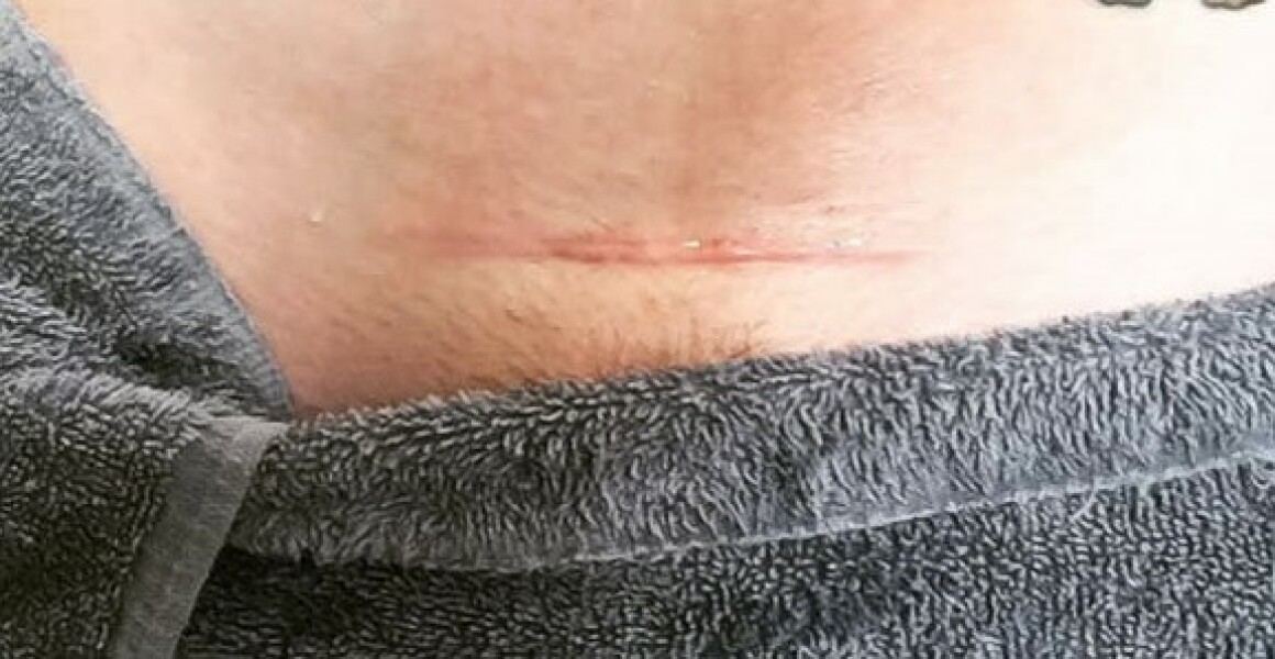 Would you judge someone for choosing to have a c section?