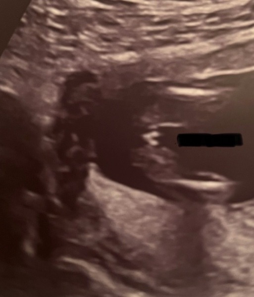 Potty shot, can you help me please!