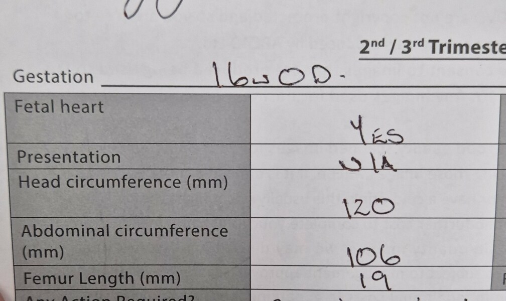 16 week ultrasound measurements