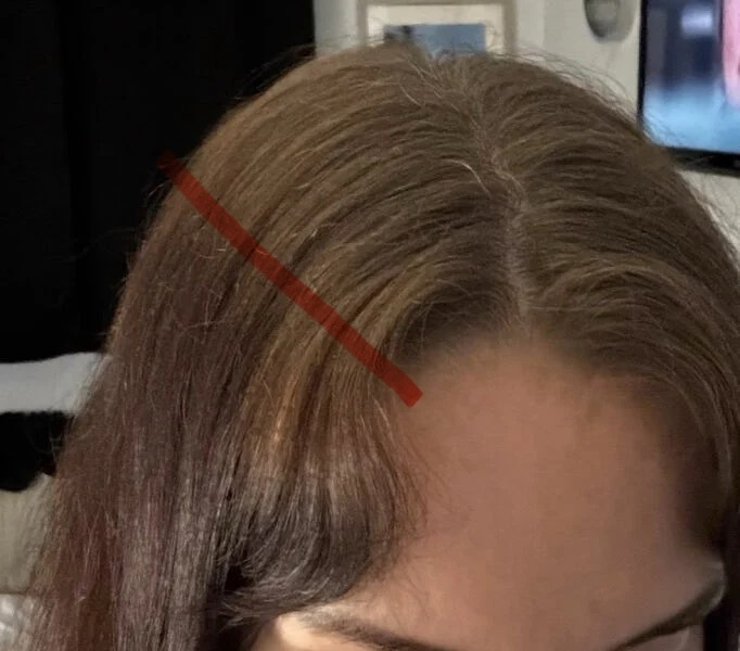 Hair growth - pic included