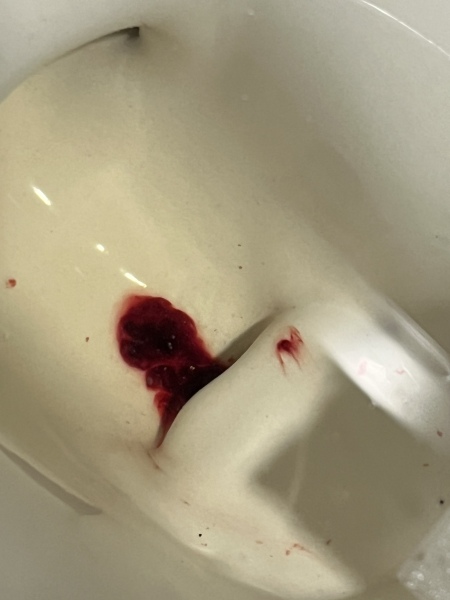 Is this a miscarriage