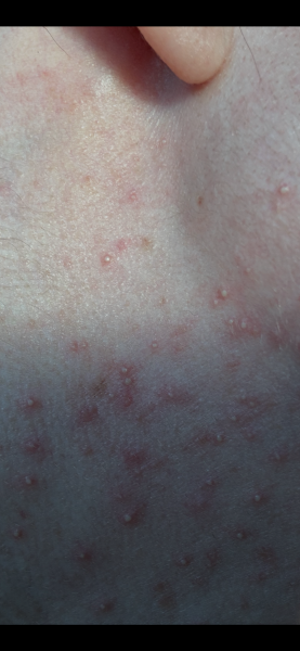 Is this an allergic reaction?
