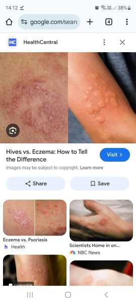 Phone call from school; they’re ’not medically trained’ ?!