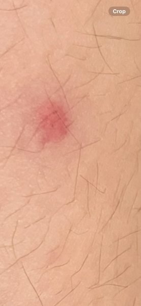 What is this (picture attached)