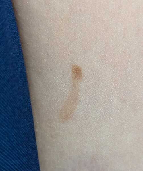 Should I be worried about this?