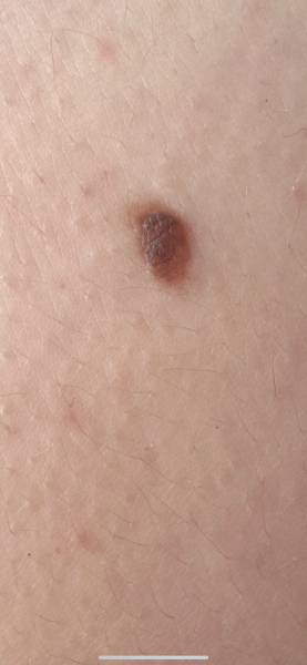 Mole changing