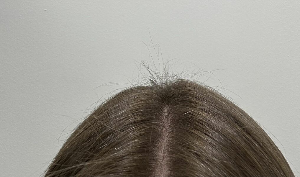 Why does my hair look like this and what can I do?