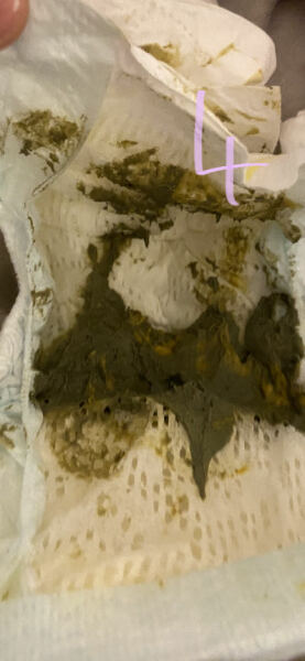 Weird poo and tummy problems (WARNING PICTURES)