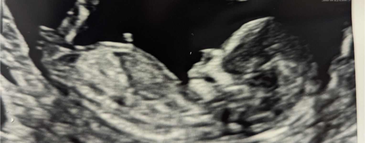 12 week scan look normal?