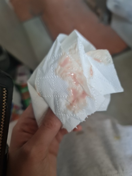 Advice please. TTC.. apologies TMI