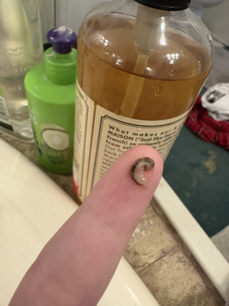 is this a misscarriage