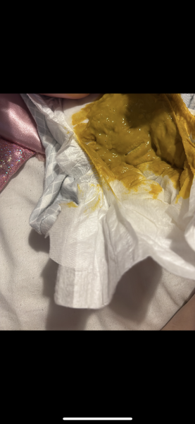 EBF nappy or allergy? Poo pics