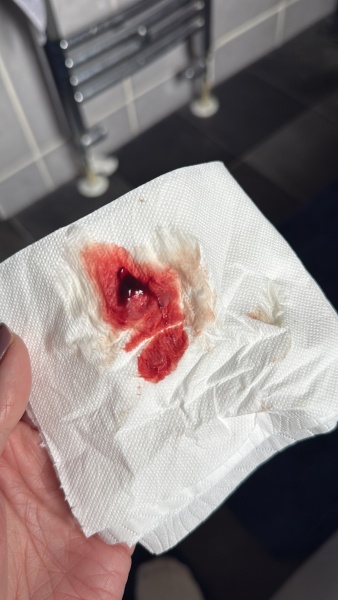 Went to EPAU yesterday for a scan, pregnancy viable, now bleeding heavily