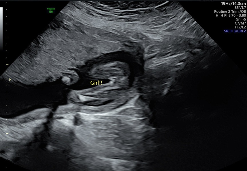 Is this definitely a girl?