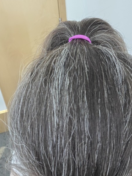 How much grey hair at 40?