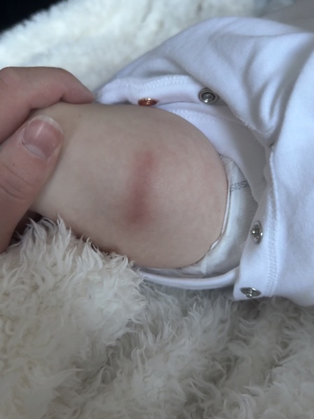 8 week vaccinations red lump