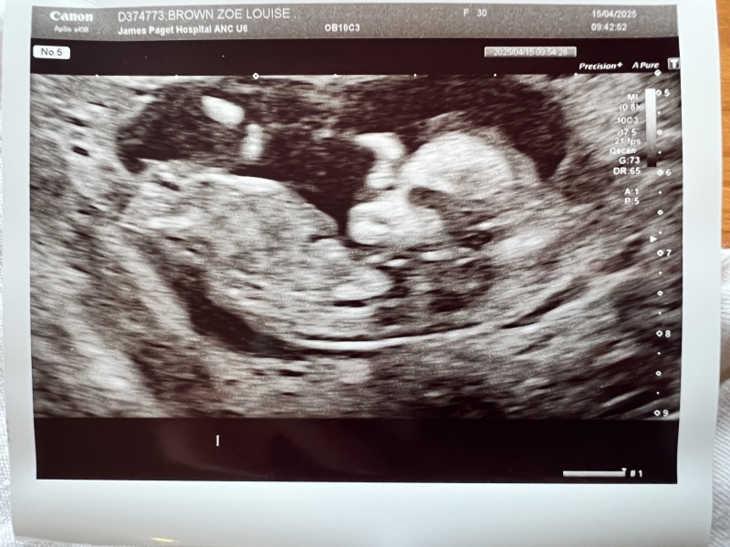 Any gender guesses please?!