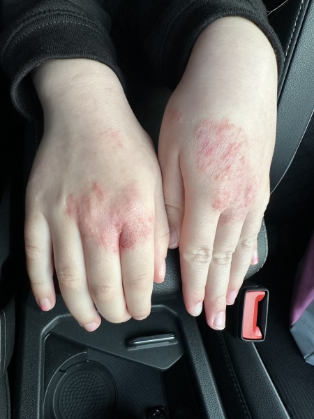 Any skin experts out there?!