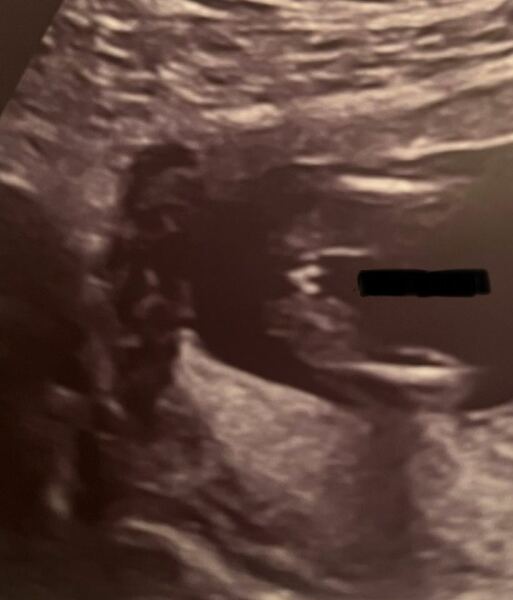 Boy or girl?