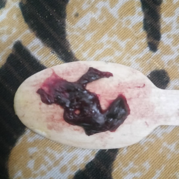 Is this a miscarriage??