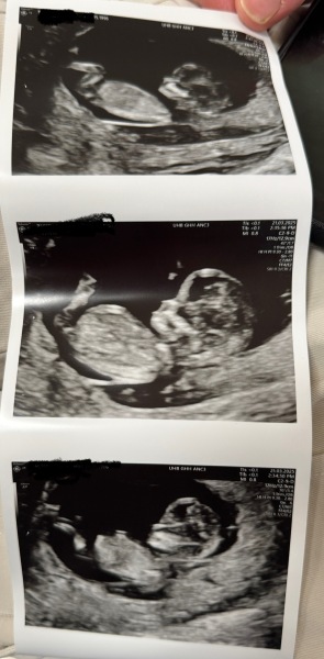 Nub theory/gender guesses