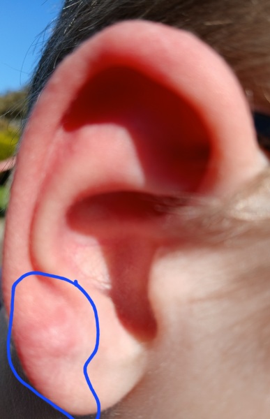 Medics of the Internet what is going on here? Pics attached