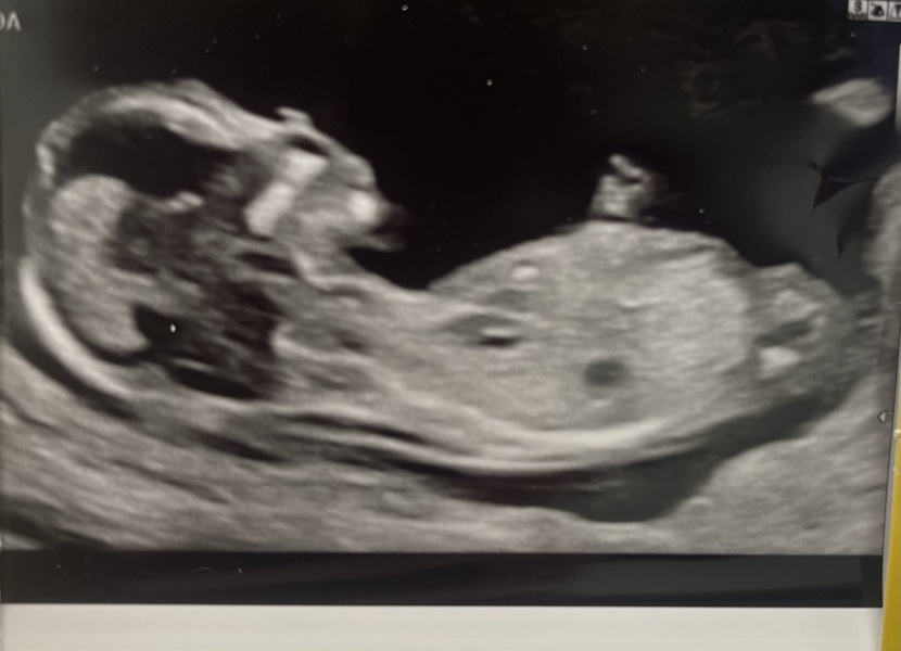 Guesses for sex of baby please