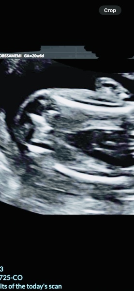 Boy or girl??? 20+5