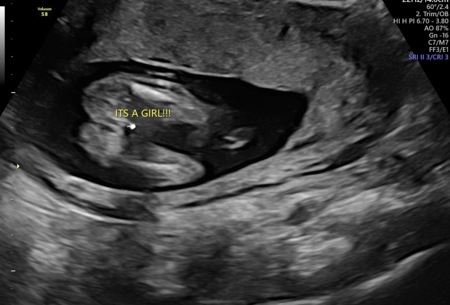 17w potty shot - can anyone confirm??