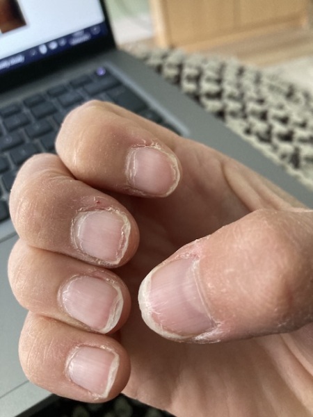 How can I fix my nails?!