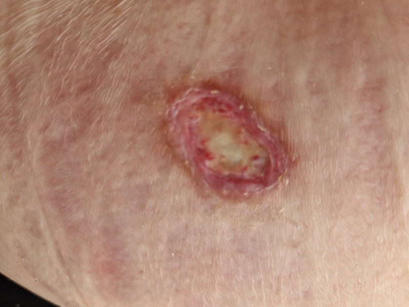 Random raw skin thing - ideas?