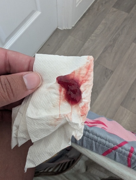 Bloody show post sweep