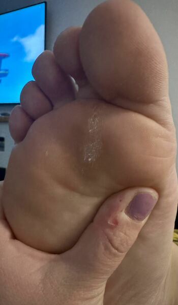 What are these on my feet !!