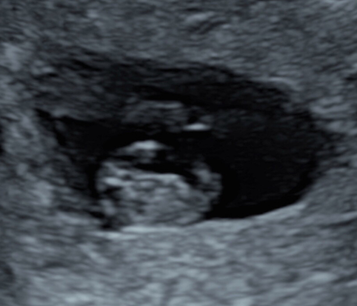 Due December 2025