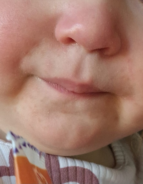 Does this look like a cold sore?