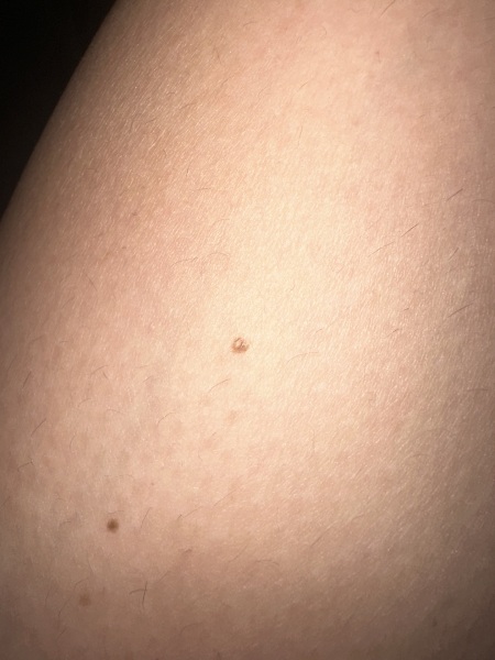 Moles