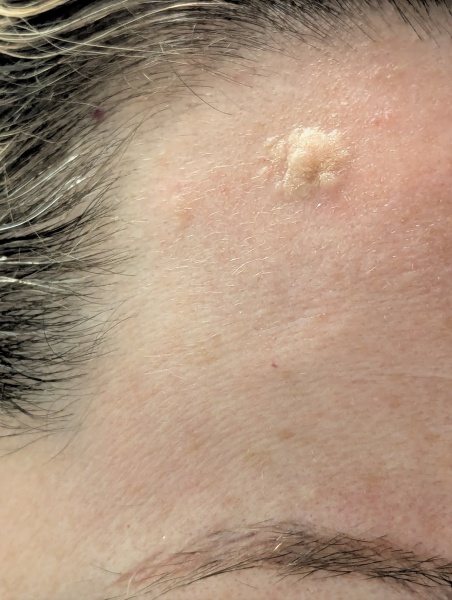 To get this removed? (And what is it?)
