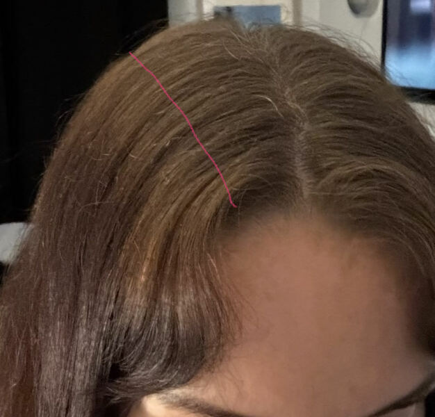 Hair growth - pic included