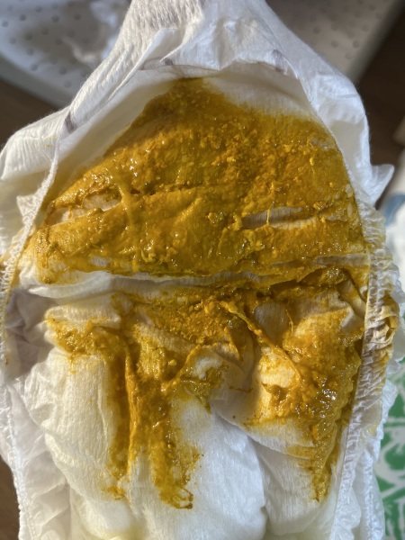 Mucus in baby poo? *pictures*