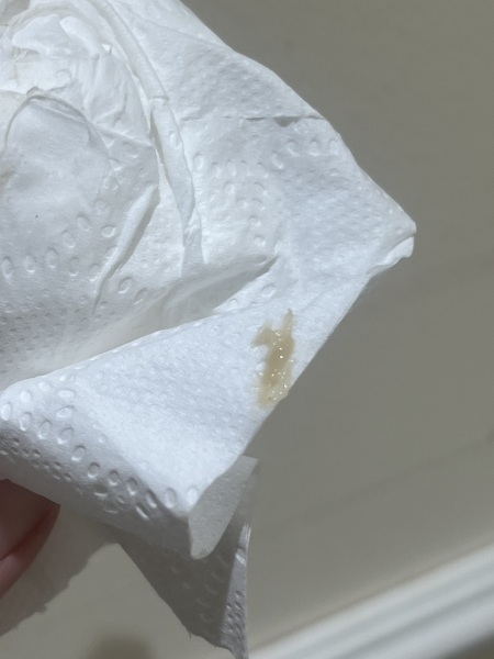 Cervical mucus / discharge?