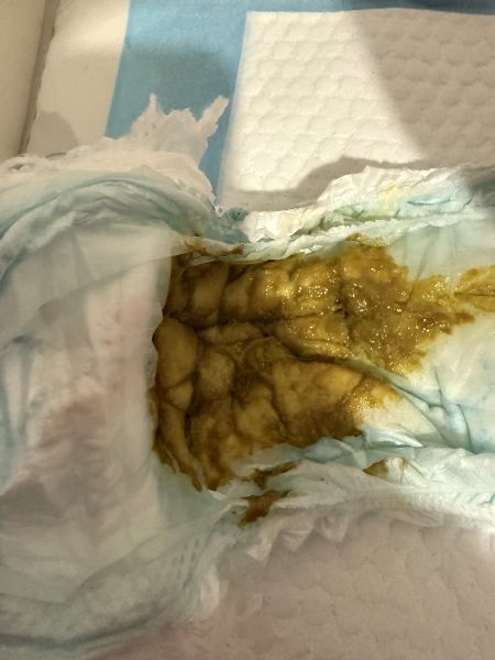 Baby Poo - is this normal?! **trigger warning - pic attached**