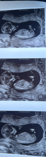 Any thoughts on boy or girl?