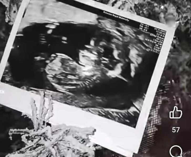 Baby gender ?