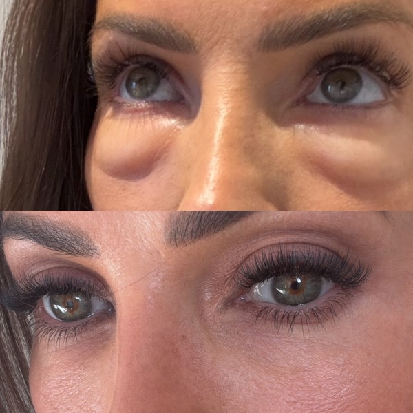 Help! Polynucleotides gone wrong