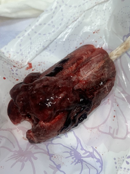 My periods never looked like this