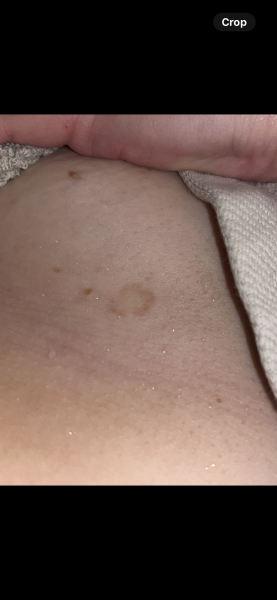 HELP, What is this on me ladies ?