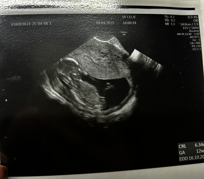 Boy or girl????