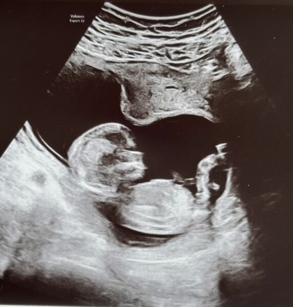 Gender guesses?